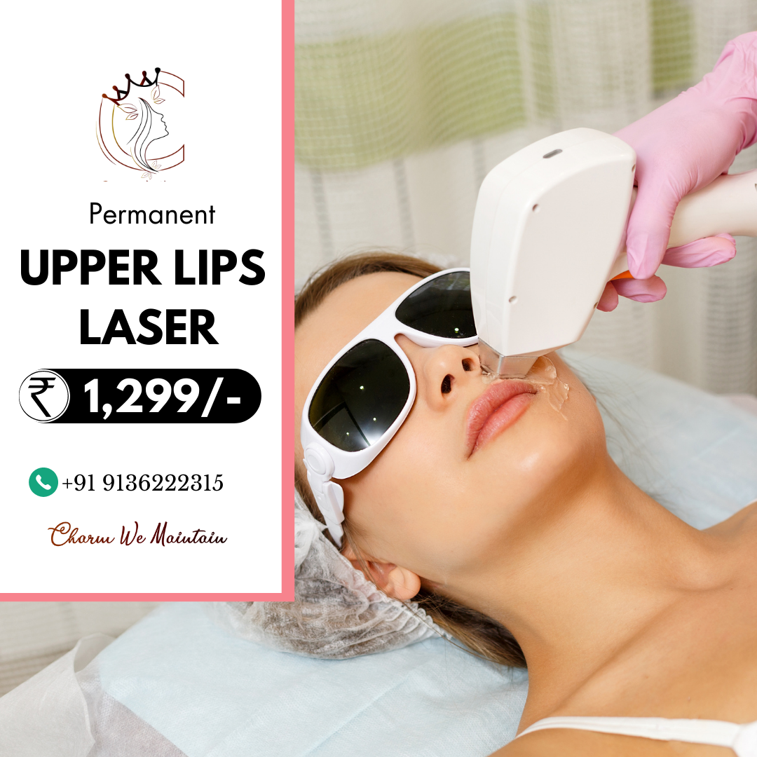 Upper Lips Laser