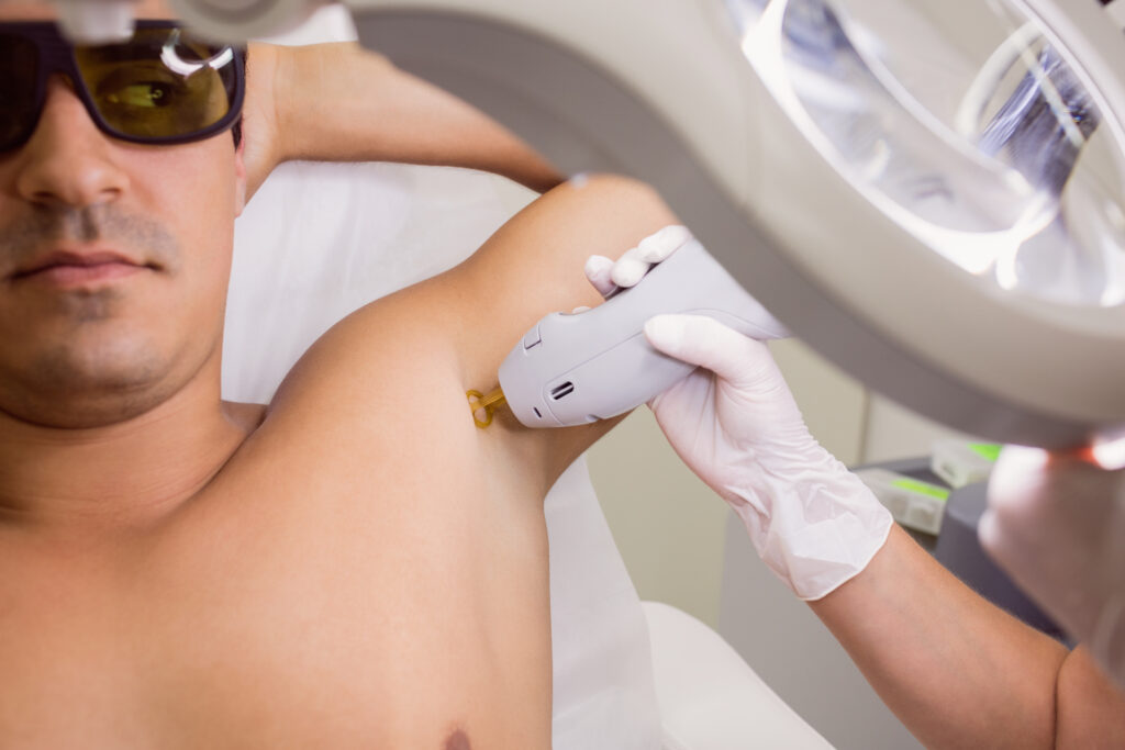 Best Laser Hair Removal in Mumbai 